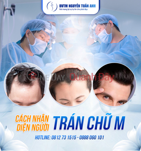 Người trán chữ M (849-9771859999)_0