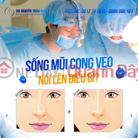 Sống mũi cong vẹo: Tướng tài lộc ? _0