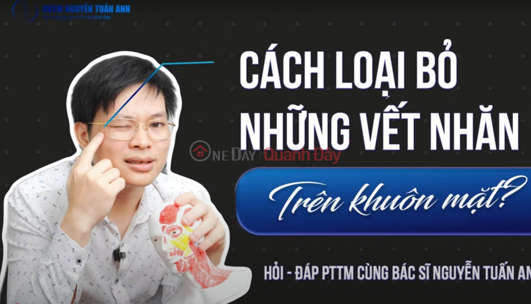 Người trán chữ M