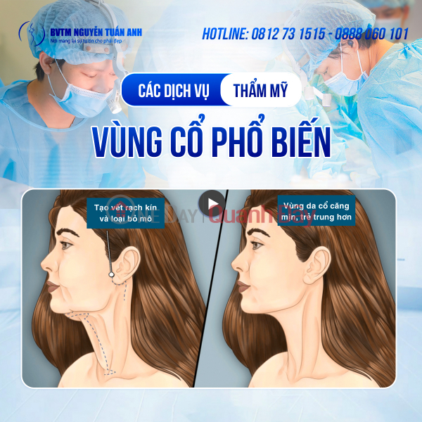 Các dịch vụ liên quan đến thẩm mỹ vùng cổ Niêm yết cho thuê