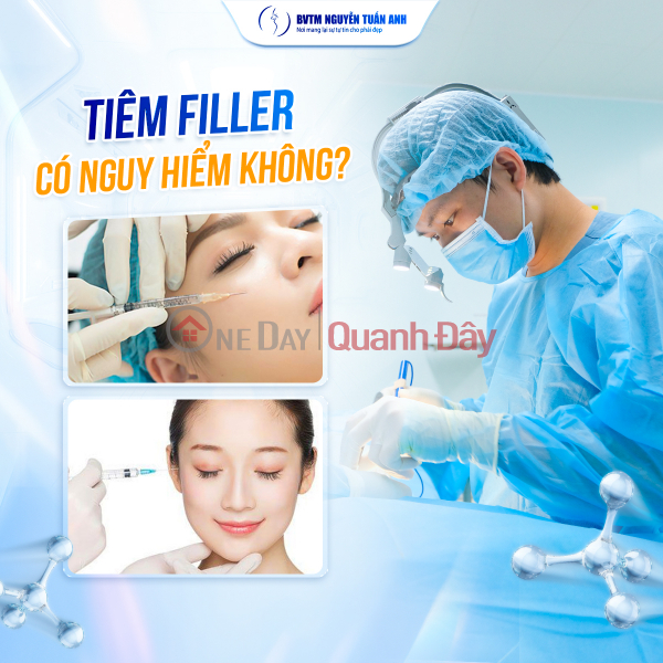 Tiêm Filler: An Toàn Hay Tiềm Ẩn Nguy Cơ Niêm yết cho thuê