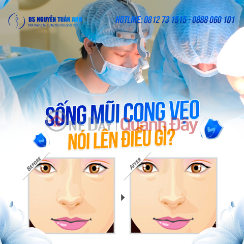 Sống mũi cong vẹo: Tướng tài lộc ? _0